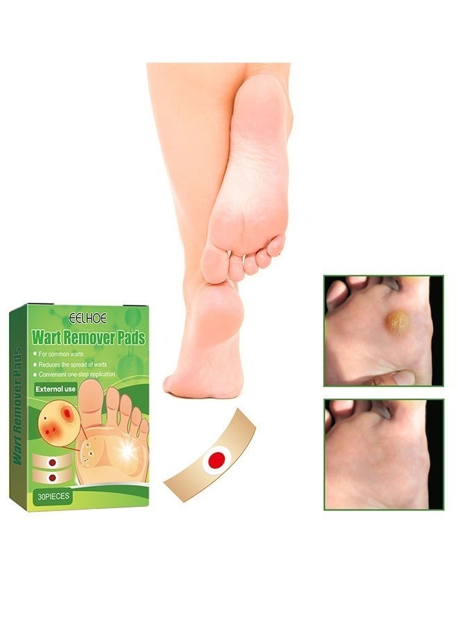 EELHOE 30 Pcs Wart Removal Pads, Treatment Relief Corn Pain and Foot Care, Clean Anti-Itting and Antibacterial Patches - Image 2
